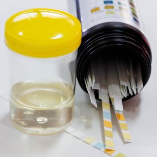 Burning when you urinate?