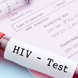 How Do You Get HIV?