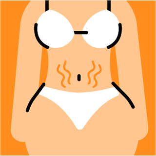 True Story: Stretch Marks All Over